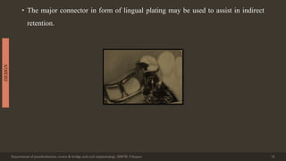 • The major connector in form of lingual plating may be used to assist in indirect
retention.
Department of prosthodontics, crown & bridge and oral implantology, DDCH, Udaipur 15
DESIGN
 