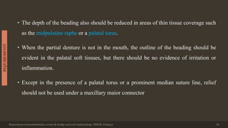 • The depth of the beading also should be reduced in areas of thin tissue coverage such
as the midpalatine raphe or a palatal torus.
• When the partial denture is not in the mouth, the outline of the beading should be
evident in the palatal soft tissues, but there should be no evidence of irritation or
inflammation.
• Except in the presence of a palatal torus or a prominent median suture line, relief
should not be used under a maxillary maior connector
Department of prosthodontics, crown & bridge and oral implantology, DDCH, Udaipur 30
REQUIREMENTS
 