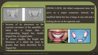 Department of prosthodontics, crown & bridge and oral implantology, DDCH, Udaipur 60
LABIAL BAR
• because of its placement on the
external curvature of the mandible, a
labial bar is longer than a
corresponding lingual bar, double
lingual bar, or lingual plate.
• To ensure rigidity, the height and
thickness of a labial bar must be
greater than those described for a
lingual bar.
SWING LOCK :the labial component does not
serve as a major connector. Instead, the
modified labial bar has a hinge at one end and a
locking device at the opposite end.
 