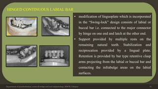 Department of prosthodontics, crown & bridge and oral implantology, DDCH, Udaipur 61
HINGED CONTINUOUS LABIAL BAR
• modification of linguoplate which is incorporated
in the “Swing-lock” design consists of labial or
buccal bar i.e. connected to the major connector
by hinge on one end and latch at the other end.
• Support provided by multiple rests on the
remaining natural teeth. Stabilization and
reciprocation provided by a lingual plate.
Retention is provided by bar type retentive clasp
arms projecting from the labial or buccal bar and
contacting the infrabulge areas on the labial
surfaces.
 