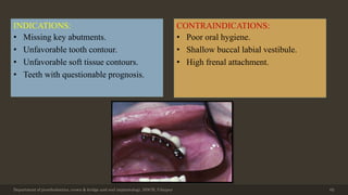 Department of prosthodontics, crown & bridge and oral implantology, DDCH, Udaipur 62
INDICATIONS:
• Missing key abutments.
• Unfavorable tooth contour.
• Unfavorable soft tissue contours.
• Teeth with questionable prognosis.
CONTRAINDICATIONS:
• Poor oral hygiene.
• Shallow buccal labial vestibule.
• High frenal attachment.
 