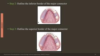 • Step 2: Outline the inferior border of the major connector
• Step 3: Outline the superior border of the major connector
Department of prosthodontics, crown & bridge and oral implantology, DDCH, Udaipur 64
DESIGN
 