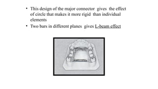 Comprehensive Overview of Major Connectors in Partial Dentures: Design ...
