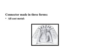 Comprehensive Overview of Major Connectors in Partial Dentures: Design ...