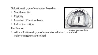 Comprehensive Overview of Major Connectors in Partial Dentures: Design ...
