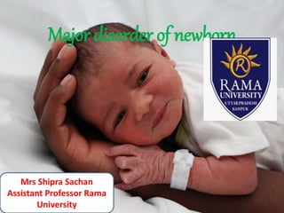 Major disorder of newborn
Mrs Shipra Sachan
Assistant Professor Rama
University
 
