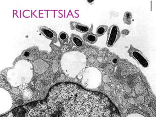 RICKETTSIAS
 