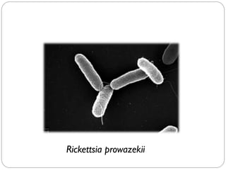 Rickettsia prowazekii
 