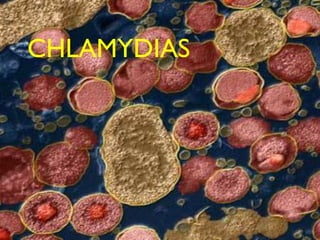 CHLAMYDIAS
 