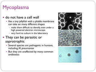 Mycoplasma
 do not have a cell wall
 like a tiny jellyfish with a pliable membrane
can take on many different shapes
 make them difficult to identify, even under a
high powered electron microscope.
 very hard to culture in the laboratory
 They can be parasitic or
saprotrophic
 Several species are pathogenic in humans,
including M. pneumoniae
 But they are unaffected by many common
antibiotics
 