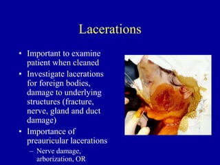 Lacerations
• Important to examine
patient when cleaned
• Investigate lacerations
for foreign bodies,
damage to underlying
structures (fracture,
nerve, gland and duct
damage)
• Importance of
preauricular lacerations
– Nerve damage,
arborization, OR
 