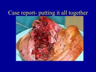 Case report- putting it all together
 