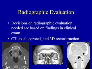 Radiographic Evaluation
• Decisions on radiographic evaluation
needed are based on findings in clinical
exam
• CT- axial, coronal, and 3D reconstruction
 