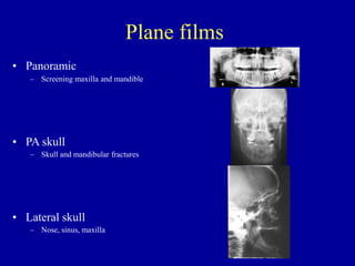 Plane films
• Panoramic
– Screening maxilla and mandible
• PA skull
– Skull and mandibular fractures
• Lateral skull
– Nose, sinus, maxilla
 