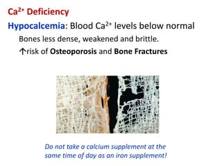 Ca2+ Deficiency
Hypocalcemia: Blood Ca2+ levels below normal
Bones less dense, weakened and brittle.
risk of Osteoporosis and Bone Fractures
Do not take a calcium supplement at the
same time of day as an iron supplement!
 