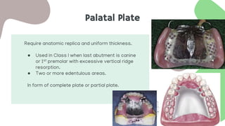 Palatal Plate
Require anatomic replica and uniform thickness.
● Used in Class I when last abutment is canine
or 1st premolar with excessive vertical ridge
resorption.
● Two or more edentulous areas.
In form of complete plate or partial plate.
 
