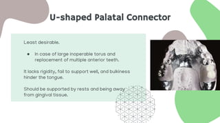 U-shaped Palatal Connector
Least desirable.
● In case of large inoperable torus and
replacement of multiple anterior teeth.
It lacks rigidity, fail to support well, and bulkiness
hinder the tongue.
Should be supported by rests and being away
from gingival tissue.
 