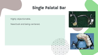 Single Palatal Bar
Highly objectionable.
Need bulk and being centered.
 