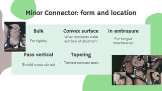Minor Connector: form and location
Bulk Convex surface
For rigidity
When contacts axial
surface of abutment
In embrasure
For tongue
interference
Pass vertical Tapering
Should cross abrupt
Toward contact area
 