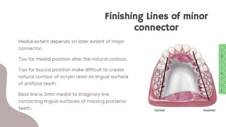 • Medial extent depends on later extent of major
connector.
• Too far medial position alter the natural contour.
• Too far buccal position make difficult to create
natural contour of acrylic resin on lingual surface
of artificial teeth.
• Best line is 2mm medial to imaginary line
contacting lingual surfaces of missing posterior
teeth.
Finishing Lines of minor
connector
 