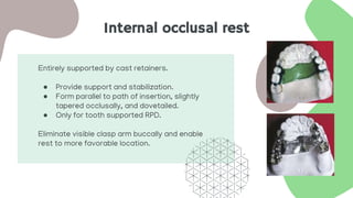 Internal occlusal rest
Entirely supported by cast retainers.
● Provide support and stabilization.
● Form parallel to path of insertion, slightly
tapered occlusally, and dovetailed.
● Only for tooth supported RPD.
Eliminate visible clasp arm buccally and enable
rest to more favorable location.
 