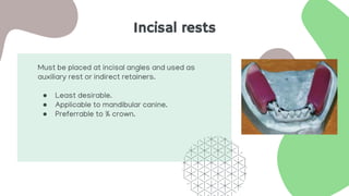 Incisal rests
Must be placed at incisal angles and used as
auxiliary rest or indirect retainers.
● Least desirable.
● Applicable to mandibular canine.
● Preferrable to ¾ crown.
 
