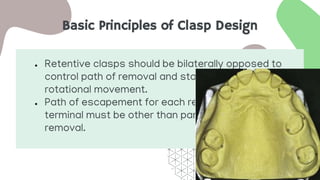 Basic Principles of Clasp Design
● Retentive clasps should be bilaterally opposed to
control path of removal and stabilize against
rotational movement.
● Path of escapement for each retentive clasp
terminal must be other than parallel to path of
removal.
 