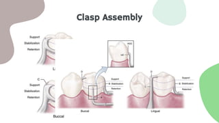 Clasp Assembly
 