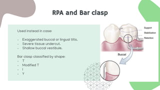 RPA and Bar clasp
Used instead in case:
- Exaggerated buccal or lingual tilts.
- Severe tissue undercut.
- Shallow buccal vestibule.
Bar clasp classified by shape:
- T
- Modified T
- I
- Y
 