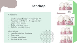 Bar clasp
Indications:
- Small degree of undercut in cervical 3rd.
- Abutment teeth for tooth supported or
modification areas.
- Distal extension base.
- Esthetic considerations.
Alternatives:
- Mesial originating ring clasp
- Cast clasp
- Wrought wire clasp
- Reverse action clasp
 