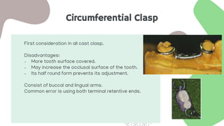 Circumferential Clasp
First consideration in all cast clasp.
Disadvantages:
- More tooth surface covered.
- May increase the occlusal surface of the tooth.
- Its half round form prevents its adjustment.
Consist of buccal and lingual arms.
Common error is using both terminal retentive ends.
 