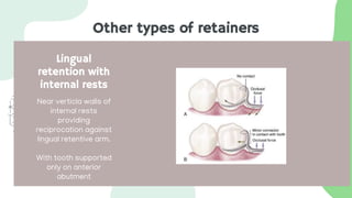 Other types of retainers
Lingual
retention with
internal rests
Near verticla walls of
internal rests
providing
reciprocation against
lingual retentive arm.
With tooth supported
only on anterior
abutment
 