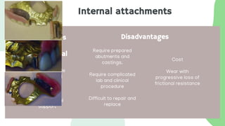 Internal attachments
Advantages
over
extracoronal
Eliminate visible
retentive and
supportive
components
Better vertical
support
Disadvantages
Require prepared
abutments and
castings.
Require complicated
lab and clinical
procedure
Difficult to repair and
replace
Cost
Wear with
progressive loss of
frictional resistance
 