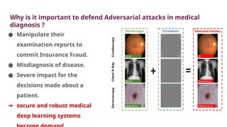 Why is it important to defend Adversarial attacks in medical
diagnosis ?
● Manipulate their
examination reports to
commit Insurance Fraud.
● Misdiagnosis of disease.
● Severe impact for the
decisions made about a
patient.
➔ secure and robust medical
deep learning systems
 