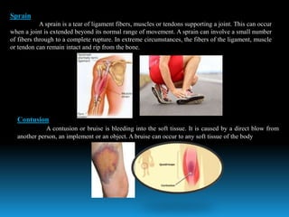 Sprained Definition Major sports injuries and classification of injuries | PPTX