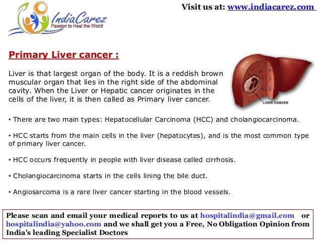 Major types of liver cancer