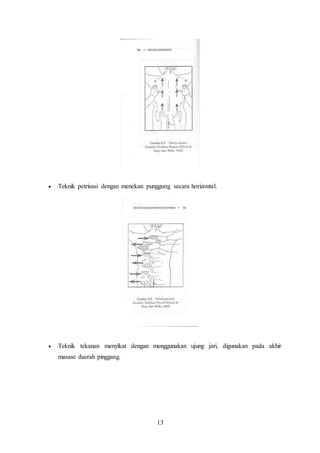13
 Teknik petrisasi dengan menekan punggung secara horizontal.
 Teknik tekanan menyikat dengan menggunakan ujung jari, digunakan pada akhir
masase daerah pinggang.
 