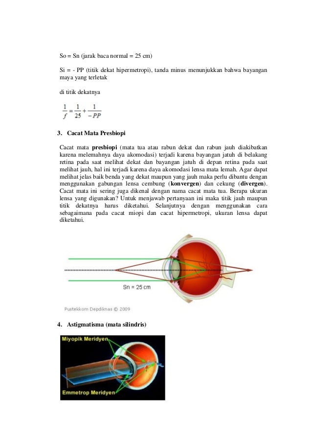 Makalah Alat Optik Mata