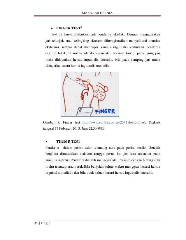 hernia pada perempuan