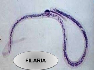 FILARIA
 