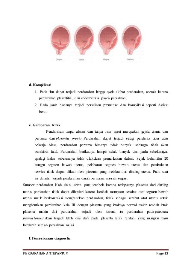 Makalah lengkap perdarahan antepartum