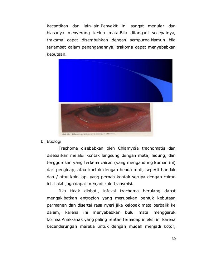 Makalah mata Makalah mata
