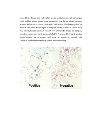 kering fiksasi dengan cara melewatkan apusan tersebut diatas nyala api dengan
cepat letakkan apusan diatas kawat penyangga yang berada diatas mangkuk
pewarna. Lalu teteskan larutan kristal violet pada apusan dan biarkan selama 30-
60 detik cuci warna dasar dengan air mengalir, keringkan teteskan larutan iodin
pada apusan, biarkan selama 30-60 detik cuci larutan iodin dengan air mengalir,
keringkan rendam atau basuh dengan alcohol 96 % selama 20-30 detik teteskan
larutan safranin, biarkan selama 30-60 detik cuci dengan air mengalir, lalu
keringkan amati dengan mikroskop gambar bentuk morfologi.
 