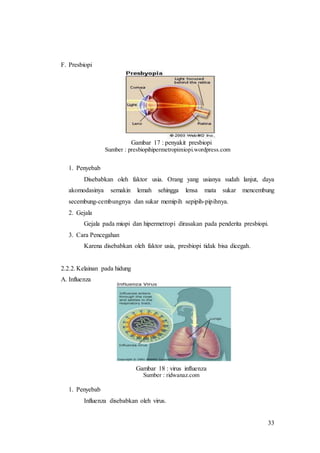 33
F. Presbiopi
Gambar 17 : penyakit presbiopi
Sumber : presbiopihipermetropimiopi.wordpress.com
1. Penyebab
Disebabkan oleh faktor usia. Orang yang usianya sudah lanjut, daya
akomodasinya semakin lemah sehingga lensa mata sukar mencembung
secembung-cembungnya dan sukar memipih sepipih-pipihnya.
2. Gejala
Gejala pada miopi dan hipermetropi dirasakan pada penderita presbiopi.
3. Cara Pencegahan
Karena disebabkan oleh faktor usia, presbiopi tidak bisa dicegah.
2.2.2.Kelainan pada hidung
A. Influenza
Gambar 18 : virus influenza
Sumber : ridwanaz.com
1. Penyebab
Influenza disebabkan oleh virus.
 