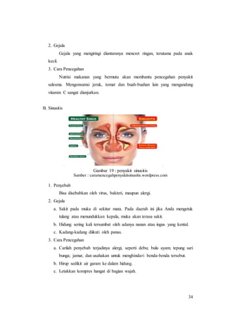 34
2. Gejala
Gejala yang mengiringi diantaranya mencret ringan, terutama pada anak
kecil.
3. Cara Pencegahan
Nutrisi makanan yang bermutu akan membantu pencegahan penyakit
salesma. Mengonsumsi jeruk, tomat dan buah-buahan lain yang mengandung
vitamin C sangat dianjurkan.
B. Sinusitis
Gambar 19 : penyakit sinusitis
Sumber : caramencegahpenyakitsinusitis.wordpress.com
1. Penyebab
Bisa disebabkan oleh virus, bakteri, maupun alergi.
2. Gejala
a. Sakit pada muka di sekitar mata. Pada daerah ini jika Anda mengetuk
tulang atau menundukkan kepala, muka akan terasa sakit.
b. Hidung sering kali tersumbat oleh adanya nanan atau ingus yang kental.
c. Kadang-kadang diikuti oleh panas.
3. Cara Pencegahan
a. Carilah penyebab terjadinya alergi, seperti debu; bulu ayam; tepung sari
bunga; jamur, dan usahakan untuk menghindari benda-benda tersebut.
b. Hirup sedikit air garam ke dalam hidung.
c. Letakkan kompres hangat di bagian wajah.
 