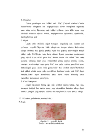 39
1. Penyebab
Proses peradangan dan infeksi pada EAC (External Auditori Canal).
Pseudomonas aeruginosa dan Staphylococcus aureus merupakan organisme
yang paling sering ditemukan pada infeksi ini.Bakteri yang lebih jarang yang
diisoloasi termasuk spesies Proteus, Staphylococcus epidermidis, diphtheroids,
dan Escherichia coli.
2. Gejala
Gejala otitis eksterna dapat beragam, tergantung dari stadium dan
perluasan penyakit.Diagnosis klinis ditegakkan dengan adanya keberadaan
otalgia, otorrhea, rasa penuh, pruritus, nyeri pada palpasi, dan beragam derajat
oklusi pada EAC.Pasien juga dapat datang dengan penurunan pendengaran
yang terjadi akibat oklusi pada EAC karena edema dan debris.Tanda otitis
eksterna termasuk nyeri pada penyentuhan pinna; adanya eritema, edema,
otorrhea, pembentukan krusta pada EAC; dan pada keadaan yang lebih berat,
limfadenopati pada nodus limfe periauricular dan servikal anterior.Perubahan
kulit akibat selulitis dapat pula muncul.Pada keadaan kronis, kulit EAC dapat
menebal.Kultur dapat bermanfaat untuk kasus infeksi berulang untuk
menetukan penanganan yang tepat.
3. Cara Pencegahan
Jangan masukkan barang apa saja kedalam saluran telinga. Apa saja,
termasuk jari-jari dan sumbu kapas yang dimasukkan kedalam telinga dapat
melukai jaringan yang melapisi saluran dan menyebabkan suatu infeksi telinga
2.2.5.Kelainan pada indera peraba ( kulit )
A. Kudis
Gambar 23 : penyakit kudis
Sumber : www.obatgatalkulit.com
 