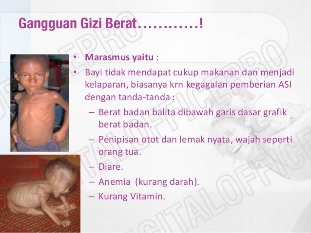 Makanan bergizi dan seimbang untuk anak