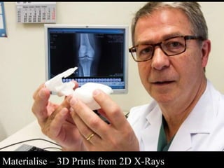 Materialise – 3D Prints from 2D X-Rays 
 