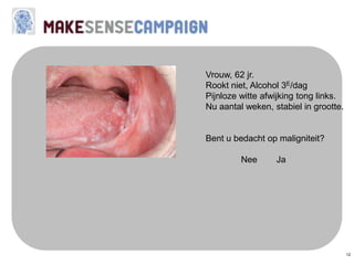 12
Vrouw, 62 jr.
Rookt niet, Alcohol 3E/dag
Pijnloze witte afwijking tong links.
Nu aantal weken, stabiel in grootte.
Bent u bedacht op maligniteit?
Nee Ja
 