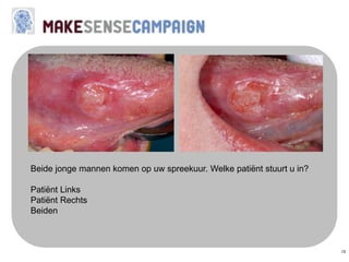 15
Beide jonge mannen komen op uw spreekuur. Welke patiënt stuurt u in?
Patiënt Links
Patiënt Rechts
Beiden
 